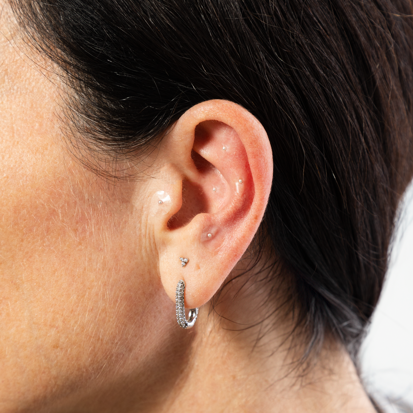 NAOWellness Silver Ear Seed Kit – Adhesive Acupressure Kit With 40+ Solutions
